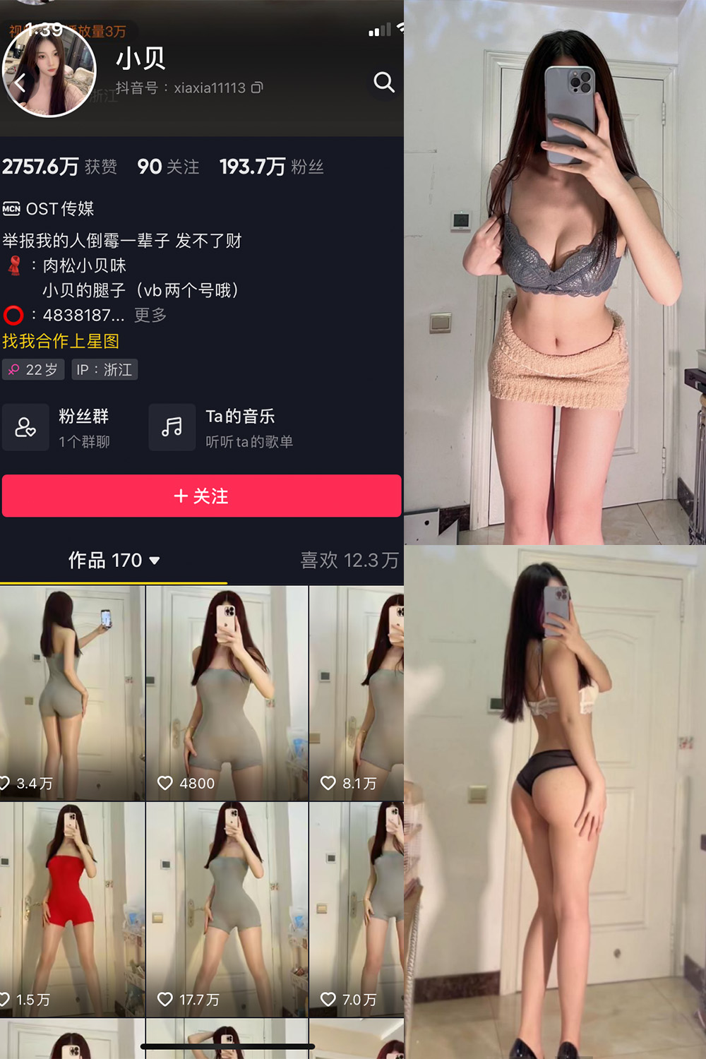 抖音 小贝 VIP 微密圈  NO.002期 【33P】-微密空间-全网最全抖音网红铁粉空间觅圈