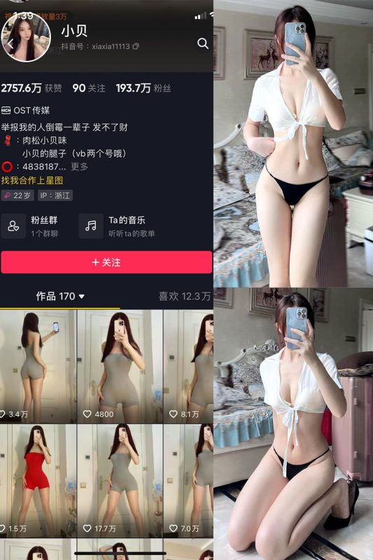 抖音 小贝 VIP 微密圈  NO.005期 【28P】-微密空间-全网最全抖音网红铁粉空间觅圈