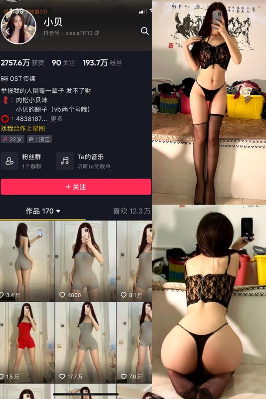 抖音 小贝 VIP 微密圈  NO.006期 【19P】-微密空间-全网最全抖音网红铁粉空间觅圈