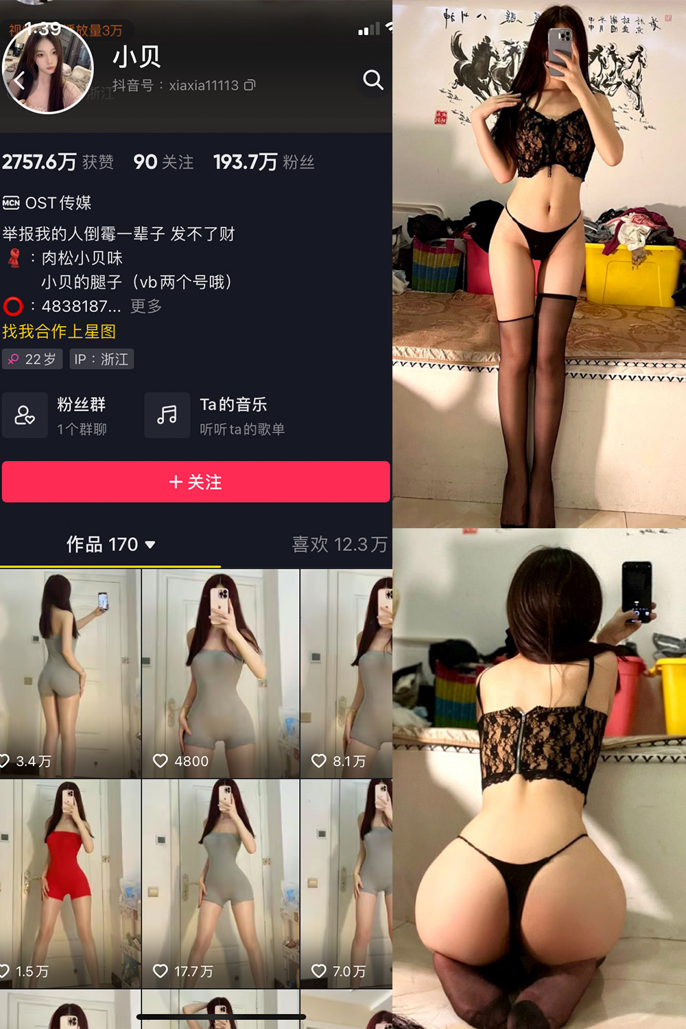 抖音 小贝 VIP 微密圈  NO.006期 【19P】-微密空间-全网最全抖音网红铁粉空间觅圈