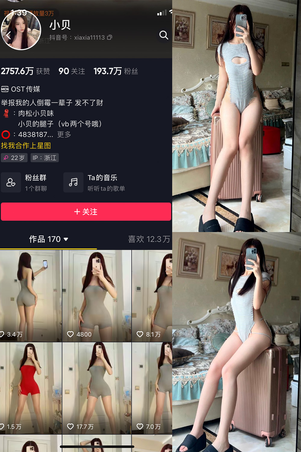 抖音 小贝 VIP 微密圈  NO.007期 【28P】-微密空间-全网最全抖音网红铁粉空间觅圈