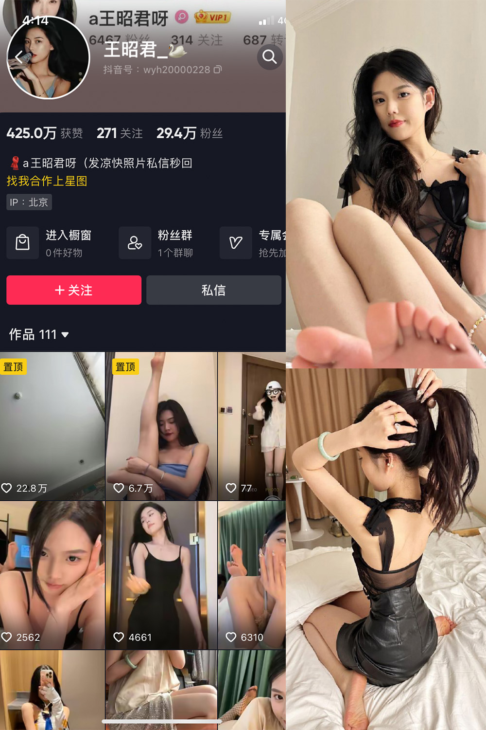 抖音 王昭君 微密圈  NO.001期 【24P5V】-微密空间-全网最全抖音网红铁粉空间觅圈