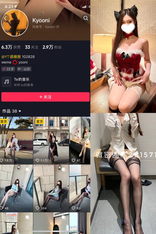 抖音 Yooni有你喵 微密圈  NO.005期 【99P】-微密空间-全网最全抖音网红铁粉空间觅圈