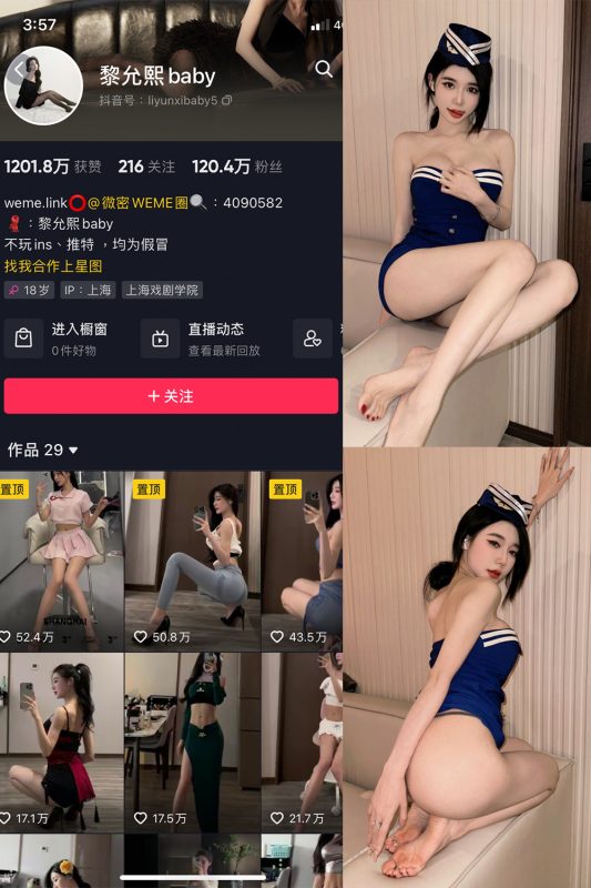 抖音 黎允熙baby 微密圈  NO.009期 【25P】-微密空间-全网最全抖音网红铁粉空间觅圈