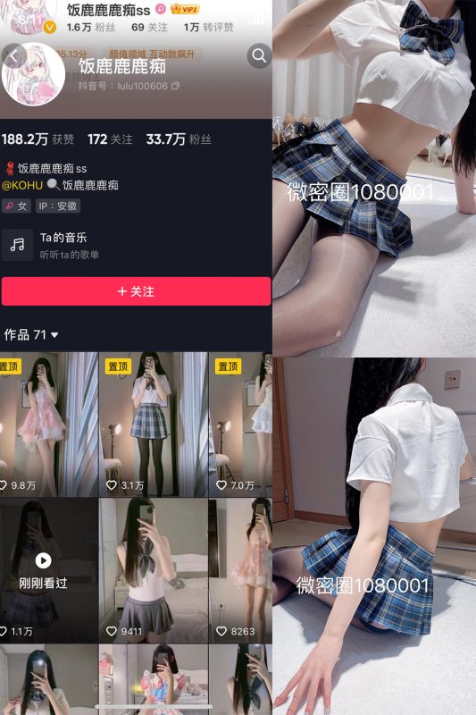 抖音 饭鹿鹿痴 微密圈  NO.014期 【20P6V】最新至：2023.9.18-微密空间-全网最全抖音网红铁粉空间觅圈