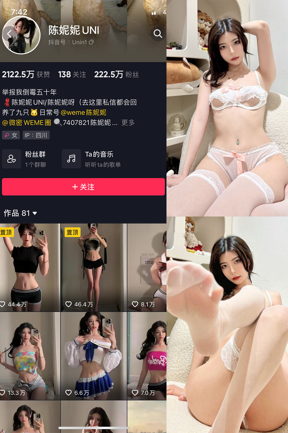抖音 陈妮腻UNI 微密圈  NO.014期 【22P】-微密空间-全网最全抖音网红铁粉空间觅圈