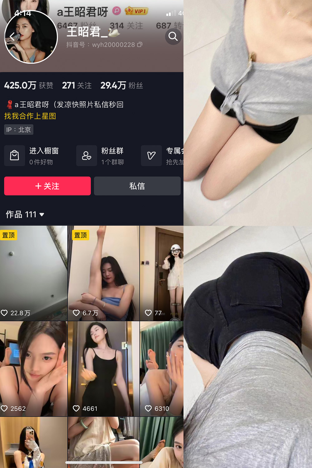 抖音 王昭君 微密圈  NO.017期 【23P】最新至：2023.10.26-微密空间-全网最全抖音网红铁粉空间觅圈