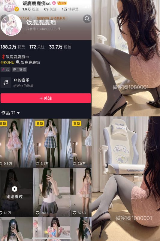 抖音 饭鹿鹿痴 微密圈  NO.020期 【19P2V】最新至：2024.1.14-微密空间-全网最全抖音网红铁粉空间觅圈