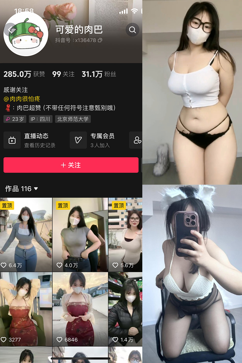 抖音 可爱的肉巴 微密圈  NO.014期 【19P12V】最新至：2024.3.7-微密空间-全网最全抖音网红铁粉空间觅圈