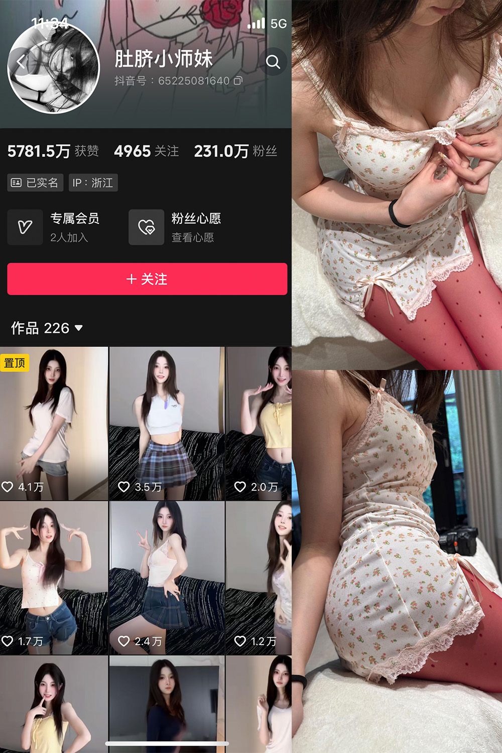 抖音 肚脐小师妹 微密圈  NO.037期 【15P2V】最新至：2025.4.13-微密空间-全网最全抖音网红铁粉空间写真