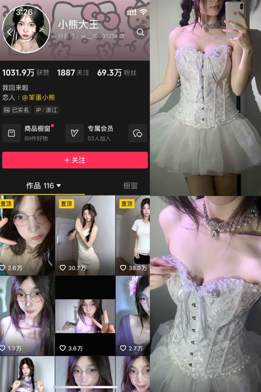 抖音 小熊大王 微密圈 001期 【32P】-微密空间-全网最全抖音网红铁粉空间觅圈