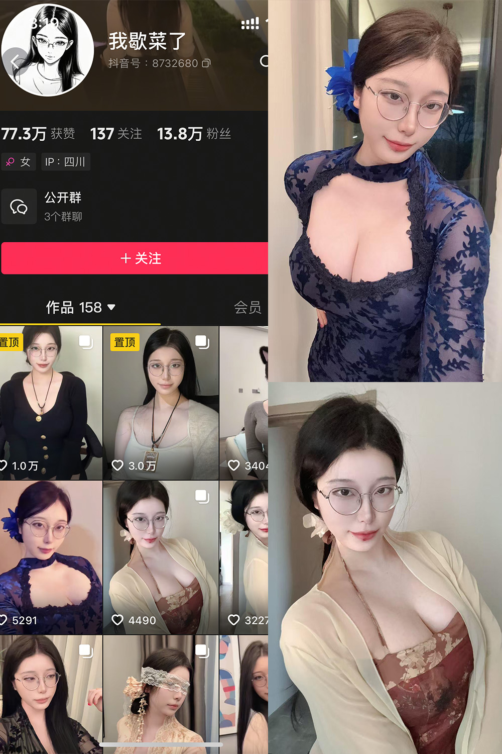 抖音 我歇菜了 微密圈 NO.001期 【10P】最新至：2025.4.19-微密空间-全网最全抖音网红铁粉空间觅圈